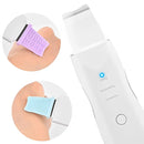 Espátula Ultrassônica Facial 5 em 1